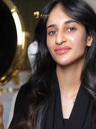 حالة كونتور كامل الوجه بالفيلر مع دكتورة نورا شقران أخصائية الجلدية  والتجميل 💕 @dr_nourashakran الحين راح تستفيدي بكاش باك 10% راجعين لك لما  تشتري عروضنا من تطبيق راما أونلاين 🌸 #Rama_clinics #كونتور ...