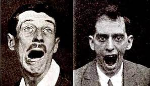 Sleeping Sickness 💤💤💤💤💤💤 In the mid 1920s, an illness known at the  time as sleeping sickness, was spreading about the United States. The  symptoms were severe and included weakness, facial distortion,  uncontrollable,