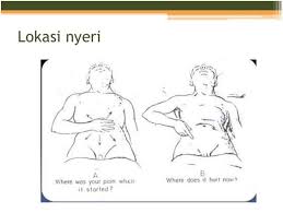 Pelakon nazrief nazri dilaporkan terpaksa ditahan di sebuah pusat perubatan di puchong selepas dia diserang sakit perut yang berpanjangan pada malam. Acute Appendicitis Rsudmangusada Badungkab Go Id