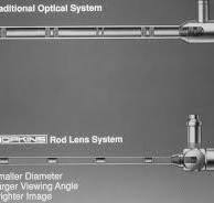 The Hopkins rod-lens system and the Storz cold light ...