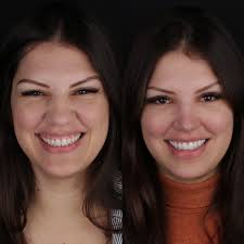 Rafael Cabello (@dr.rafacabello) • Instagram photos and videos