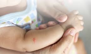 Walaupun tampaknya sepele, namun gigitan nyamuk bisa membuat bayi merasa tidak nyaman. Hermina Hospitals Demam Berdarah Pada Anak