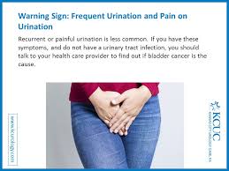 Some symptoms of bladder cancer are also symptoms of other conditions, and should prompt a visit to your physician. Warning Signs Causes Of Bladder Cancer Beware And Aware Ppt Download