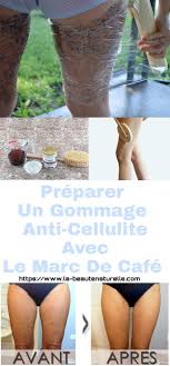 Pin On Combattre La Cellulite