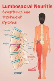Pin On My Old Friend Back Pain Not