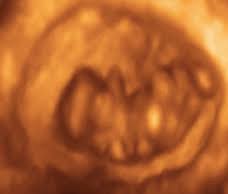 You Are 8 Weeks And 6 Days Pregnant Familyeducation