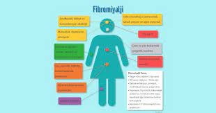 Fibromiyalji, kaslarda, kemiklerde ve yumuşak dokularda kronik ağrı oluşmasına neden olan bir sağlık sorunudur. Fibromiyalji Nedir Tedavisi Dr Emel Gokmen
