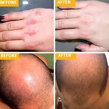 Fro butter w/ emu oil hair growth review #1: Emu Spirit 100 Australian Pure Emu Oil