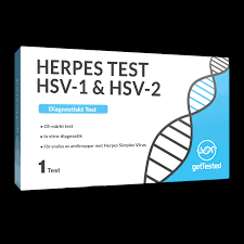 Image result for Herpes Simplex Virus Testing