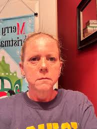 Hello! I suddenly developed severe pain in my left eye this morning. I  rubbed it for a few mins (likely a bad idea) and throughout the day it has  worsened. I saw