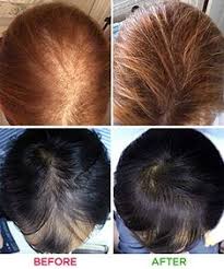 The big 3 shampoo has emu oil to moisturize the scalp, biotin, niacin, and saw palmetto. 11 Best Hair Growth Products Ideas Hair Growth Hair Hair Loss Treatment