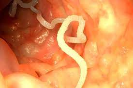 Tudo Sobre Vermes Intestinais Tua Saude