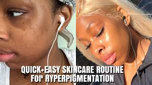 It is also full of moisturizing amino acids and. How To Get Rid Of Hyperpigmentation Fast Brown Black Girl Friendly Youtube Black Skin Care Dark Spots Skin Care Hyperpigmentation Skin Care Dark Spots
