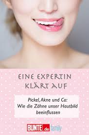 Eine Expertin Klart Auf Pickel Akne Und Co Wie Die Zahne Unser Hautbild Beeinflussen Haut Akne Gesundheit Und Schonheit