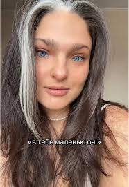 Маленькі очі та синдром Ваарденбурга