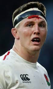 Tom Curry left with blood pouring down his face during England's win over  France