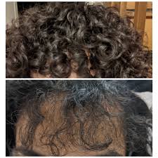 For lasting texture and beachy waves,. Hormonal Issues Are Causing My Hair To Change Texture Along My Hairline It Looks Nice On Top But If You Look Underneath My Bangs Are Like Steel Wool And The Hair Won T