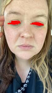 Please house help me my face is always red cause by cream what kind of  cream will I use to make it clear