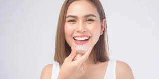 How Long Does It Take for Invisalign to Work?