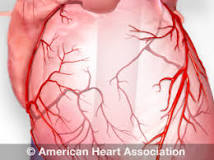 Image result for what are treatment for small arteries in heart with blockage