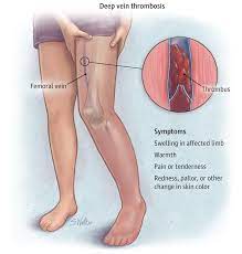 Pin On Patient Information Pages