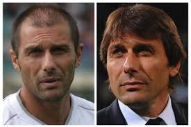 La clinica è specializzata nel trapianto di capelli e si trova nel centro della capitale albanese (tirana). Nadal Come Conte Quando Il Trapianto Di Capelli E Sportivo