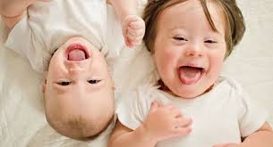 Svjetski dan sindroma Down