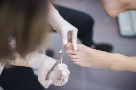 Your vet will clip the hair around the affected nail and trim all the other nails. Ingrown Toenail 3 Simple Steps To Avoid Getting One