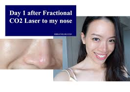 But what really annoys me are my large pores on my nose, and the junk in them! Dr Rachel Ho How To Get Rid Of Large Pores Myths And Truths