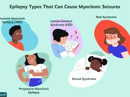 While some seizures cause no symptoms, others produce movements or changes in behavior, sensation or level of consciousness. Myoclonic Epilepsy Symptoms Causes Diagnosis And Treatment