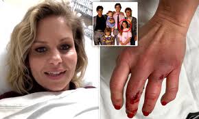Candace helaine cameron bure was the youngest of four children, born in panorama city, los angeles, california to robert and barbara cameron. Candace Cameron Bure Shows Off Gruesome Hand Injury As She S Sent To The Emergency Room Daily Mail Online