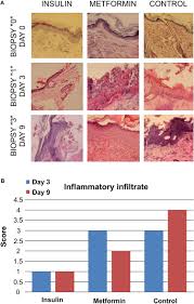 Metabolic benefits are enhanced in the presence of weight loss and weight loss itself may be enhanced in the presence of metformin (8). Insulin But Not Metformin Supports Wound Healing Process In Rats Wit Dmso