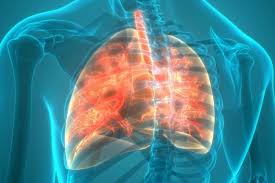 Learn more about the symptoms, causes, diagnosis, and treatment of cystic fibrosis from webmd. Cystic Fibrosis Towards Better Treatment And Stronger Lungs
