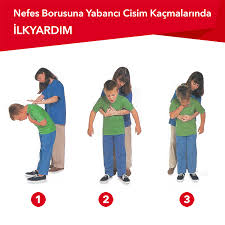 Eğer bebek öksürüyorsa veya sesler çıkarıyorsa boğazına kaçan nesneyi çıkarması için öksürmesine izin verin. Cocuklarda Bogulma Heimlich Manevrasi Uzay Tokuzay Tok