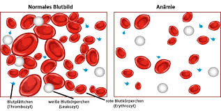 Ein blutbild sieht für viele patienten kryptisch und verwirrend aus. á Laborwerte Blutwerte Blutbild Und Befunde Richtig Verstehen