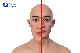 10 bệnh về tuyến yên thường gặp và đối tượng nguy cơ mắc bệnh