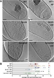 HF-treated sacculi of S. coelicolor ΔmatAB and Δcsla appear thinner.... |  Download Scientific Diagram