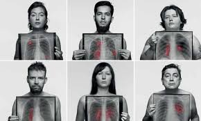 Various factors can cause this mutation to happen. Gps Urged To Be More Alert In Diagnosing Lung Cancer In Non Smokers Lung Cancer The Guardian