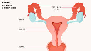 Do you experience pain or abnormal discharge. Pelvic Inflammatory Disease Risk Factors Symptoms Treatments
