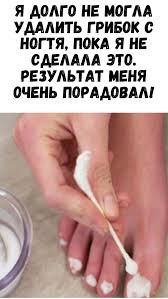 как избавиться от грибка в ухе в домашних условиях Pin Ot Polzovatelya Kenzhe Satymkulova Na Doske Poleznyj Sovet