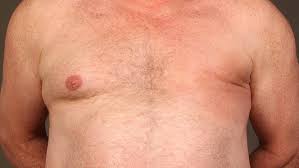 All men have some breast tissue. 9 11 Survivor Shocked By Breast Cancer Diagnosis But I M A Man Fox News