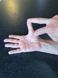 Image result for Carpal Compression Test