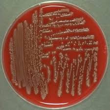 Coli (expec) strains that infect extraintestinal sites, including urinary tract, meninges, bloodstream, lungs, and surgical sites. How Can Microbiome Affect The Urinary Tract Onkonytt