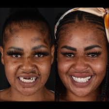 At your service ~ 𝒟𝓇 𝒮𝓂𝒾𝓁𝑒® ♥️🇿🇦🦷👨🏻‍⚕️ #projectsmilesa #drsmile