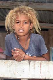 The Fact That Historically People Believe That Naturally Blonde Hair Is From Europe Because Melanesia Black And Blonde Natural Blondes Beautiful Face