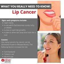 Image result for Lip Cancer