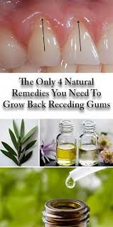 Les 4 Seuls Remedes Naturels Dont Vous Avez Besoin Pour Repousser Les Gencives En Recul Health Remedie Soins Des Gencives Gencive Remedes Naturels