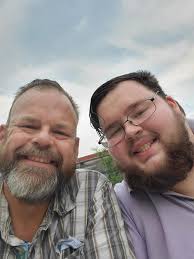 Kidney Update I had my dialysis permacatheter removed today. I've had a  love-hate relationship with this thing. When I woke up from my coma, I had  this strange device sticking out of