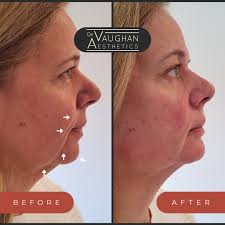Dr Vaughan Aesthetics