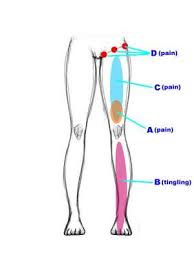 Pin On Unlock Hip Flexor Tips